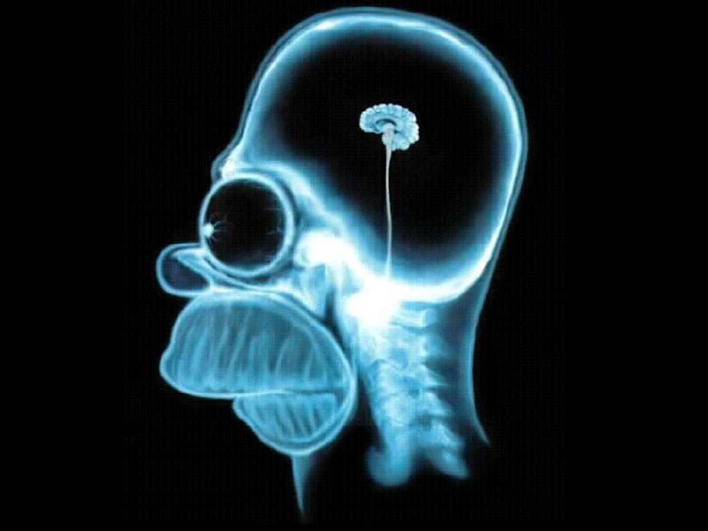 Homer-Brain-X-Ray-the-simpsons-60337_1024_768